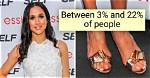10+ Rare Body Features That You Might Have