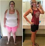 Before & After Plenity Weight Loss Pictures