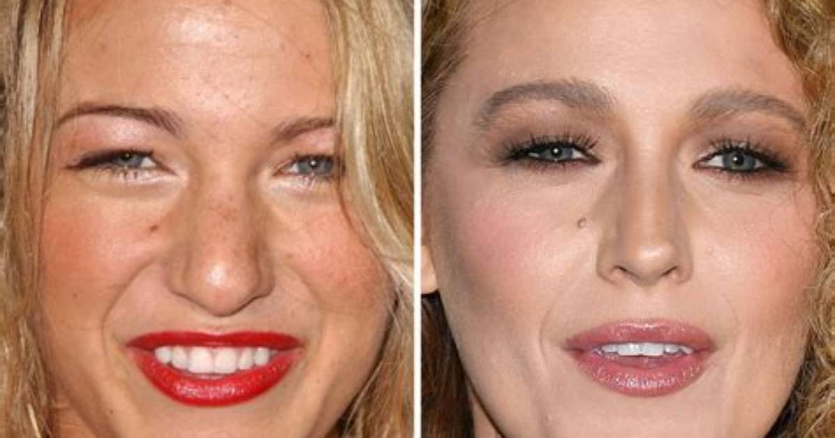 Blake Lively Before and After the Rumoured Nose Job She's Never Admitted to |