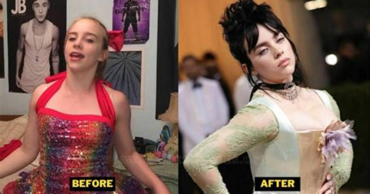 Did Billie Eilish Have Breast Reduction? Exploring the Truth Behind the Rumors
