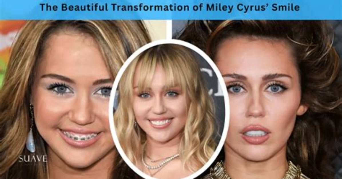 Did Miley Cyrus Slap a Fan? the Truth Behind the Controversy