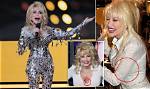 Dolly Parton Admitted She Has Tattoos to Cover "Scars and Things" |
