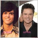 Donny Osmond's Plastic Surgery Journey