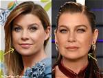 Ellen Pompeo's Scar: the Story Behind Her Iconic Mark