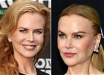 Enhance Your Beauty: Nicole Kidman's Transformative Rhinoplasty Journey
