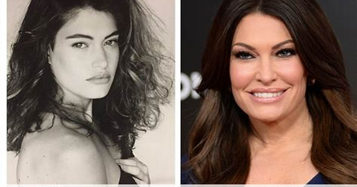 Exploring the Evolution: Kimberly Guilfoyle Before and After Images