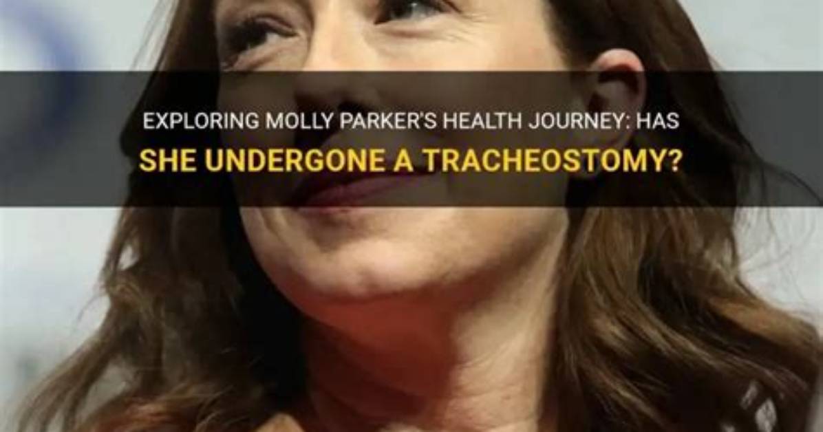 Exploring the Life and Journey of Molly Luttle