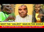 Exploring the "Ugliest Man Alive"