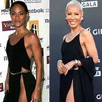 Jada Pinkett's Rhinoplasty: Transformation and Controversy