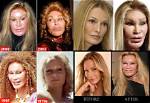 Jocelyn Wildenstein Before Plastic Surgery: Her Look