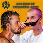 Justin Bieber: a Journey from Then to Now