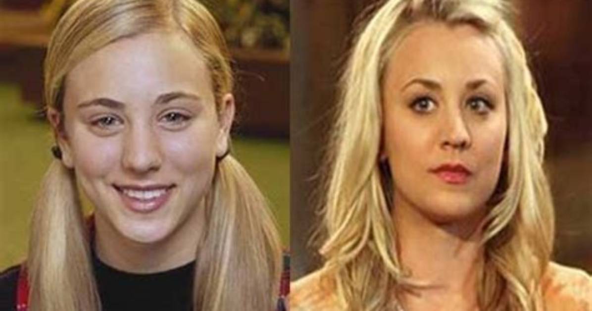 Kaley Cuoco's Journey with Breast Augmentation
