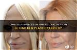 Kimber Jaynes: the Story Behind Her Botched Procedures