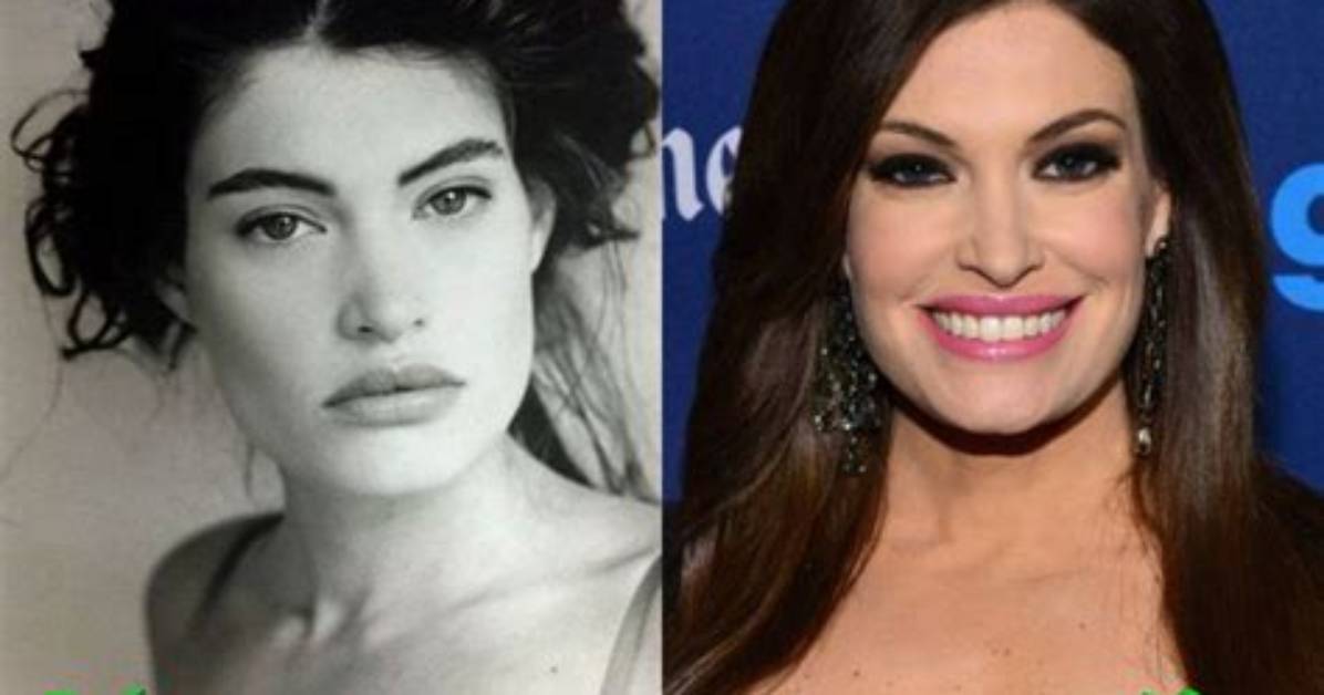 Kimberly Gilfoyle: a Transformation Before and After