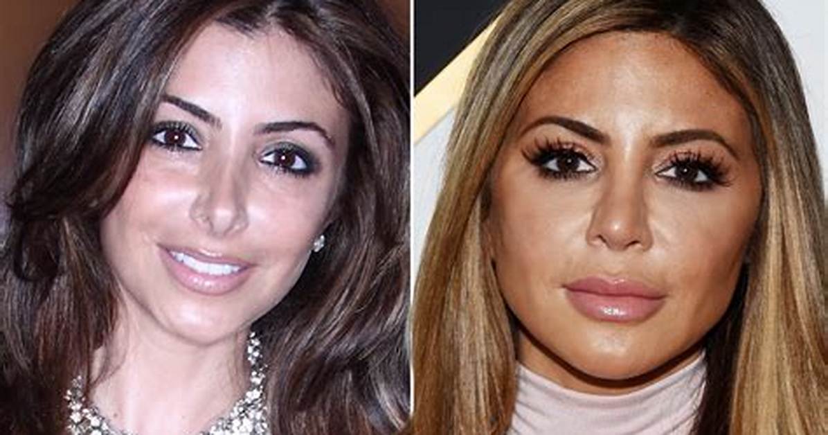 Larsa Pippen Plastic Surgery, Larsa Pippen Before and After Plastic Surgery