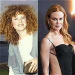 Remarkable Transformation: Nicole Kidman's Plastic Surgery Journey