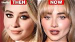 Sabrina Carpenter's Journey: Pre Surgery Insights