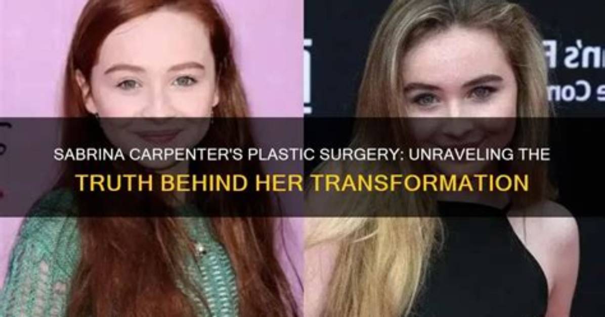 Sabrina Carpenter's Transformation: the Truth Behind Her Face Surgery