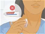 Say Goodbye to Hickeys: Effective Ways to Get Rid of Them