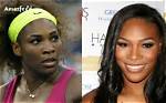 Serena Williams' Face Surgery Journey