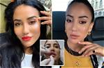 Tamara Kalinic: a Journey Through Surgery and Transformation
