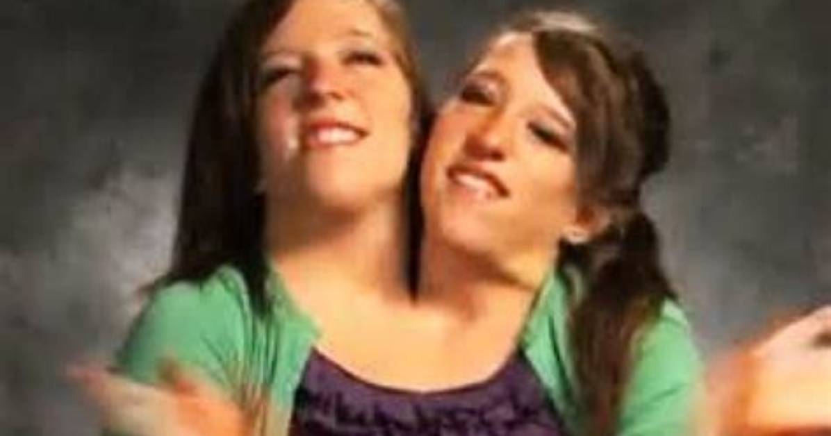 The Fascinating Journey of the Hensel Twins: a Comprehensive Insight