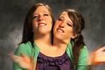 The Fascinating Journey of the Hensel Twins: a Comprehensive Insight