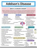 The Ultimate Guide to Adasha Disease: Symptoms, Diagnosis, and Treatment