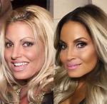 Trish Stratus Plastic Surgery: Before and After Photos
