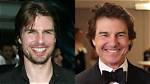 Unique Smiles: Exploring Actors with Underbites