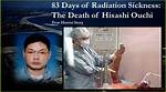 Unraveling the Tragic Tale of Hisashi Ouchi and Radiation Exposure