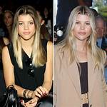 Unveiling Sofia Richie's Plastic Surgery Secrets: Discoveries and Insights