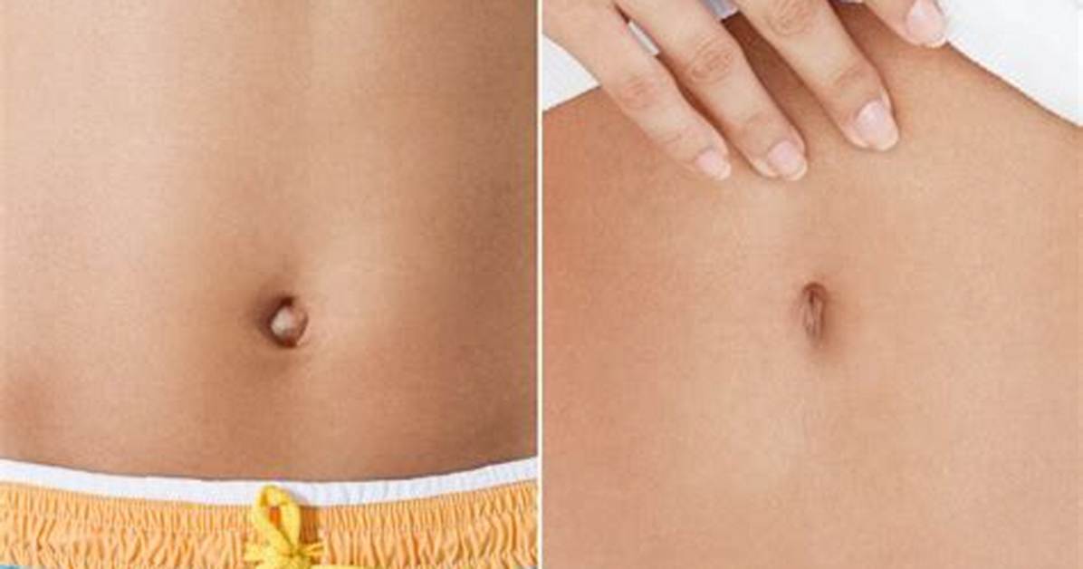 Unveiling the Fascinating World of Belly Button Mold