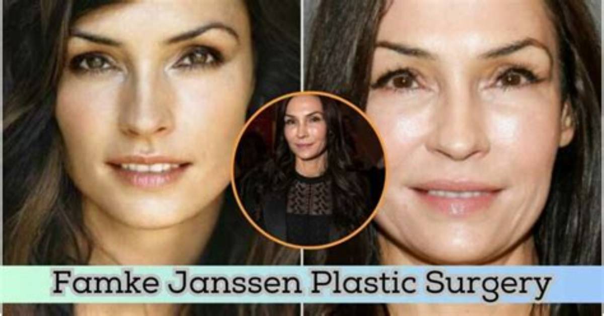 Unveiling the Truth Behind Famke Janssen Surgery