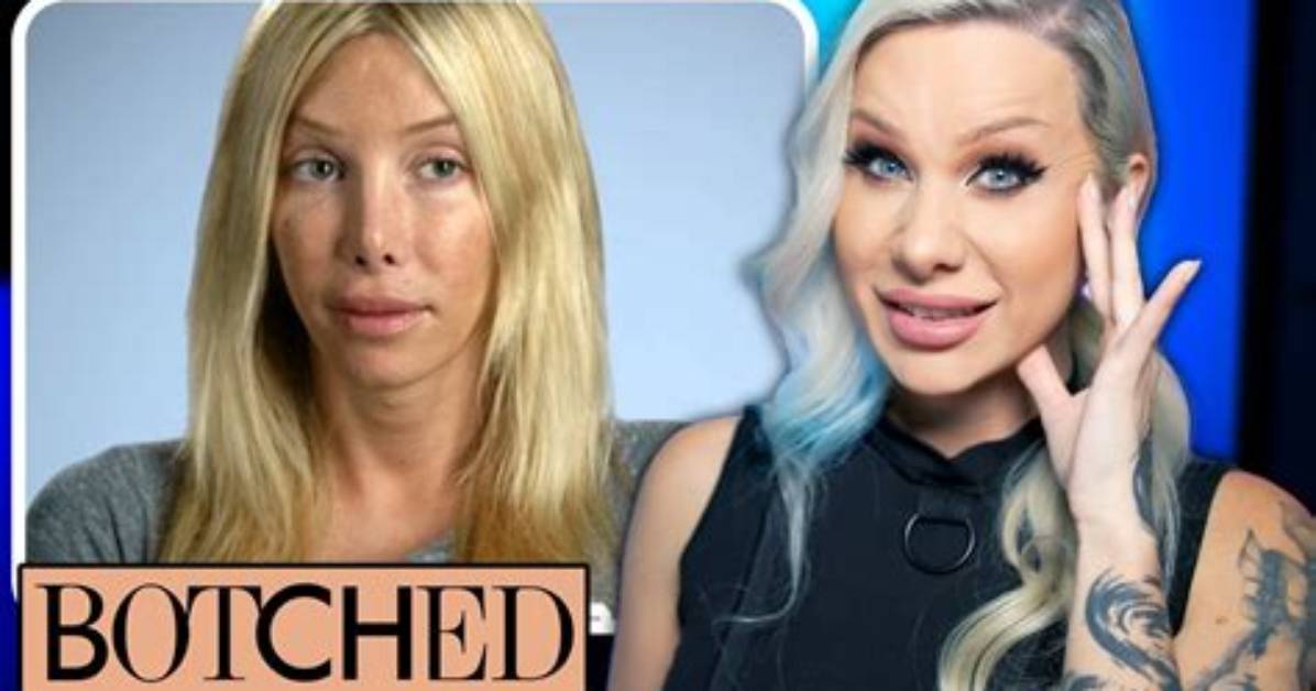 Unveiling the Truth Behind Kimber James Botched