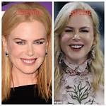 Unveiling the Truth Behind Nicole Kidman's Body Image: Is She Really "Fat"?