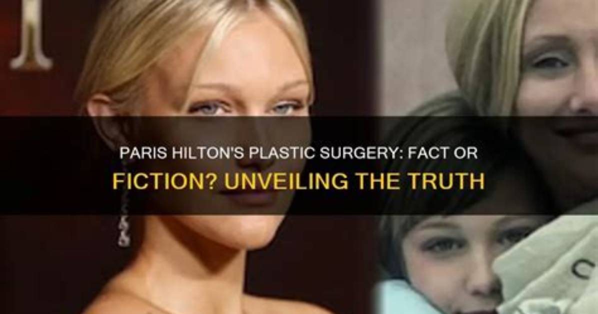 Unveiling the Truth Behind Paris Hilton's Nose Job: a Celebrity Transformation