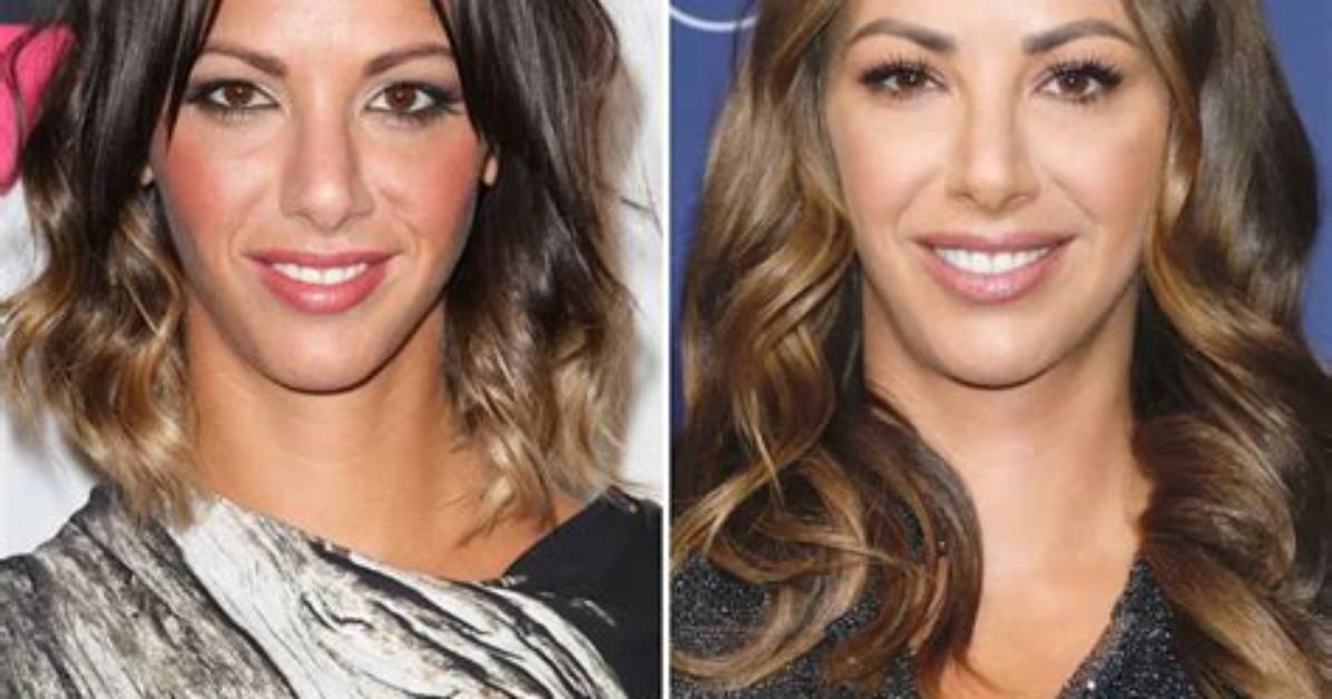 Unveiling the Truth: Did Kristen Doute Get Breast Implants?
