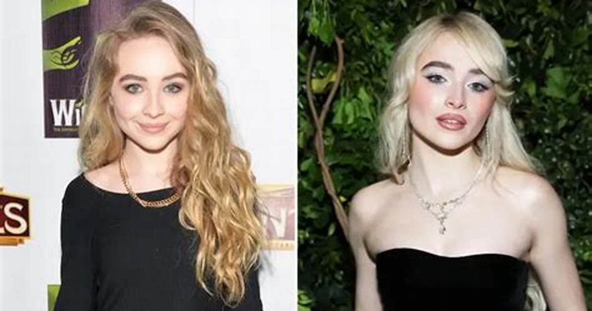 Unveiling the Truth: Has Sabrina Carpenter Gotten Plastic Surgery?