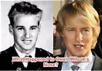 What Really Happened to Owen Wilsons Nose and How Did He Break It? ·